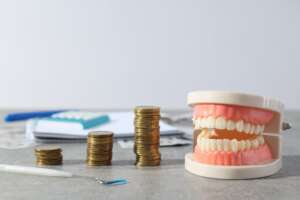 Dental Implant Costs: What Affects the Price and Is It Worth It?