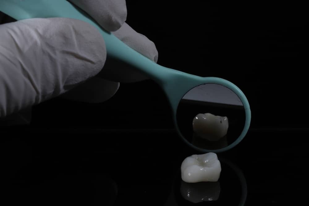 What is a Dental Crown? UK Patient’s Complete Guide to Tooth Crowns