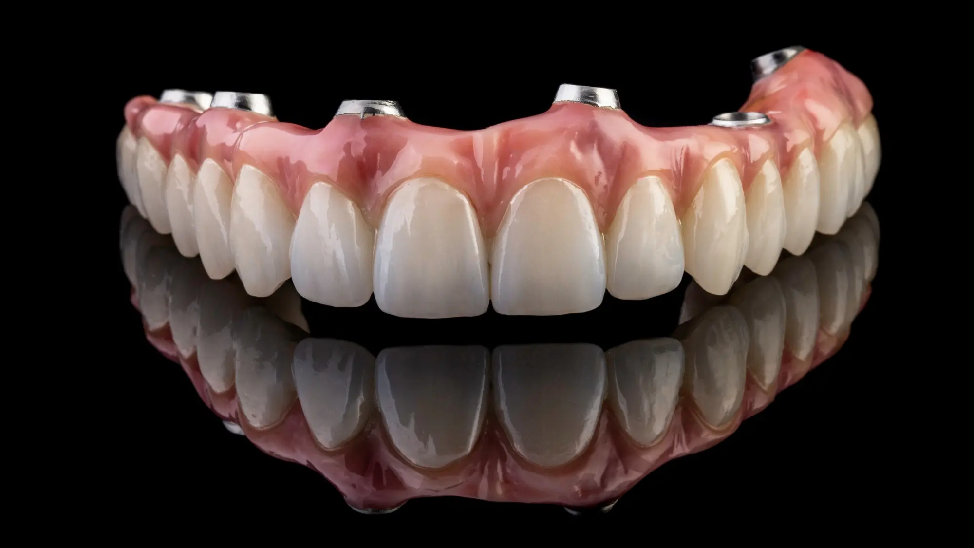 Full Arch Dental Implants- A Permanent Solution for Missing Teeth Dental Harmony Turkey Blog